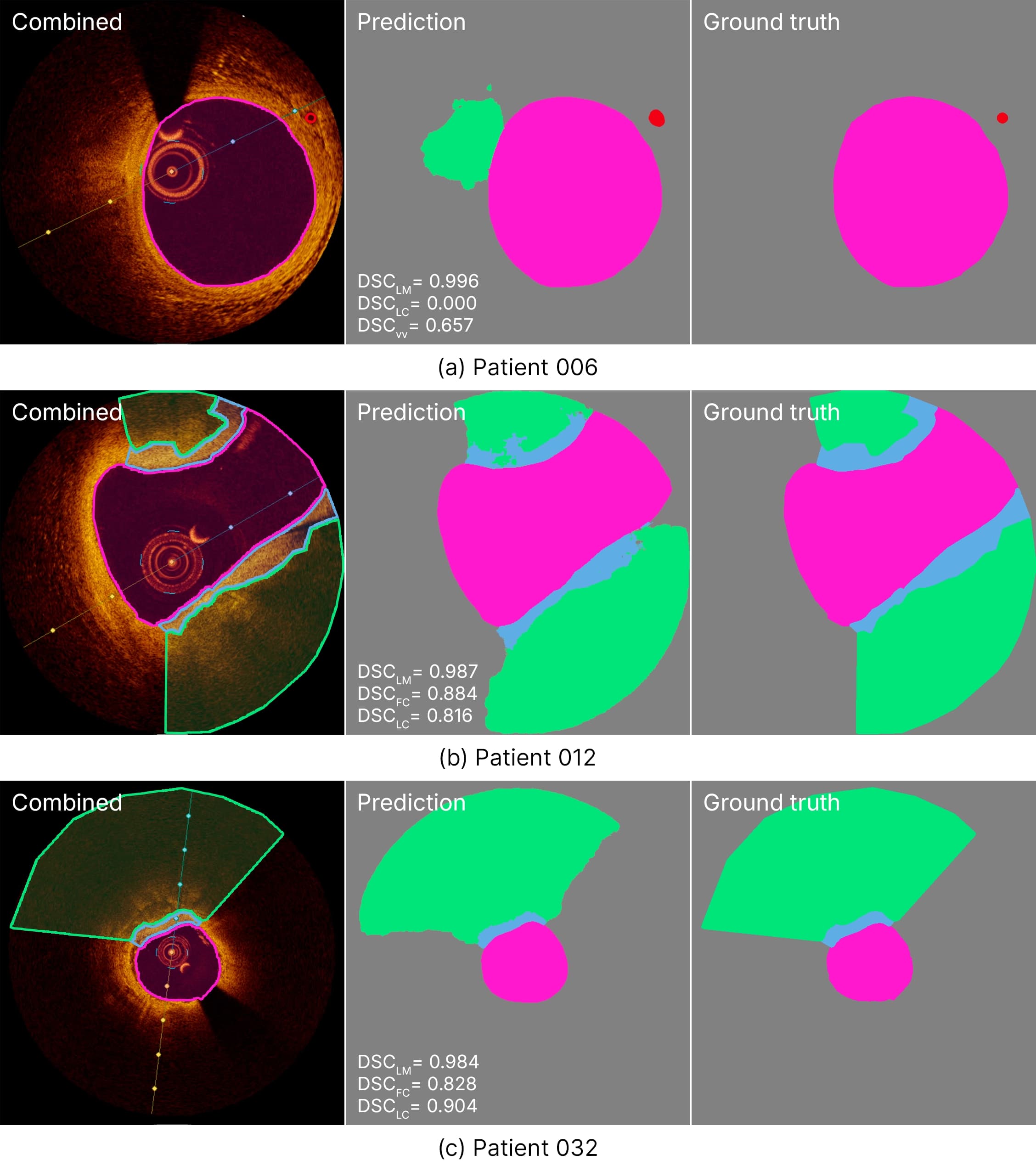 Comparison of Ground Truth and Model Predictions