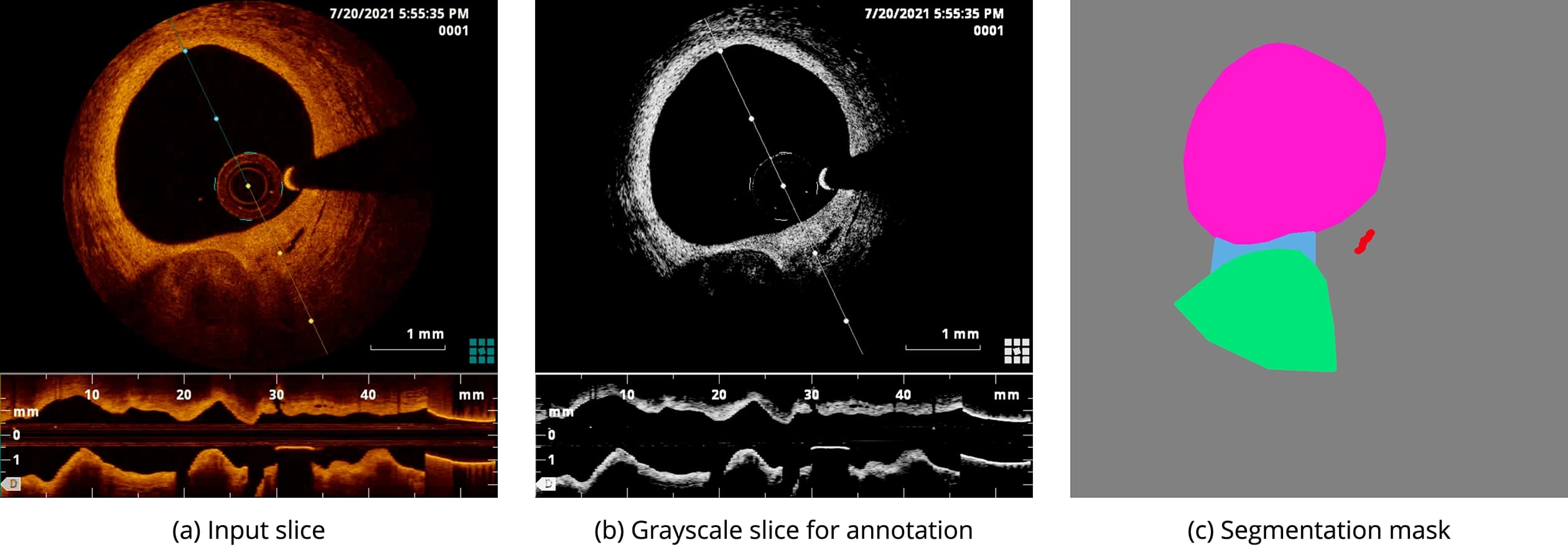 OCT Annotation Methodology