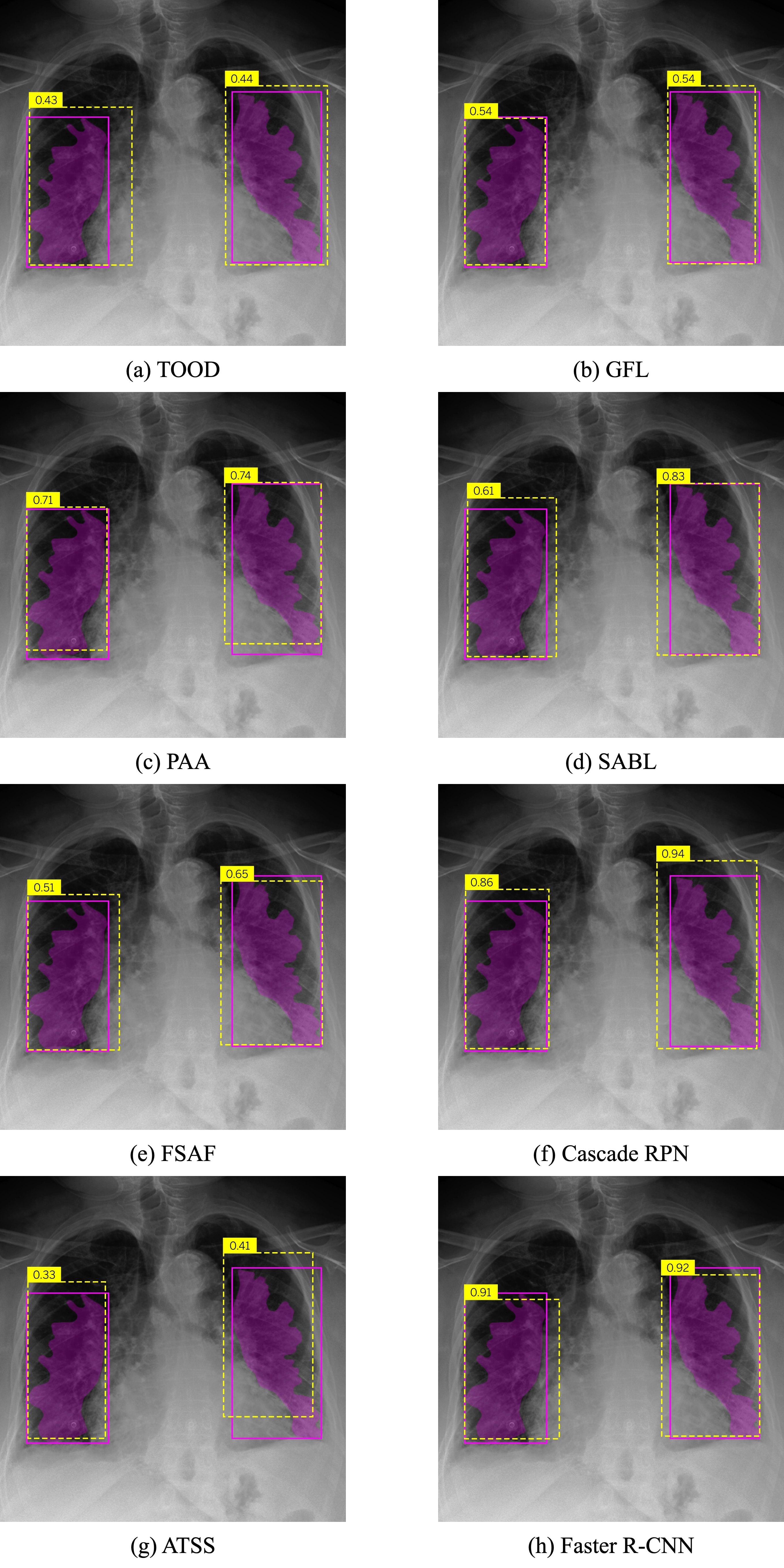 Comparison of Bat Wing Predictions