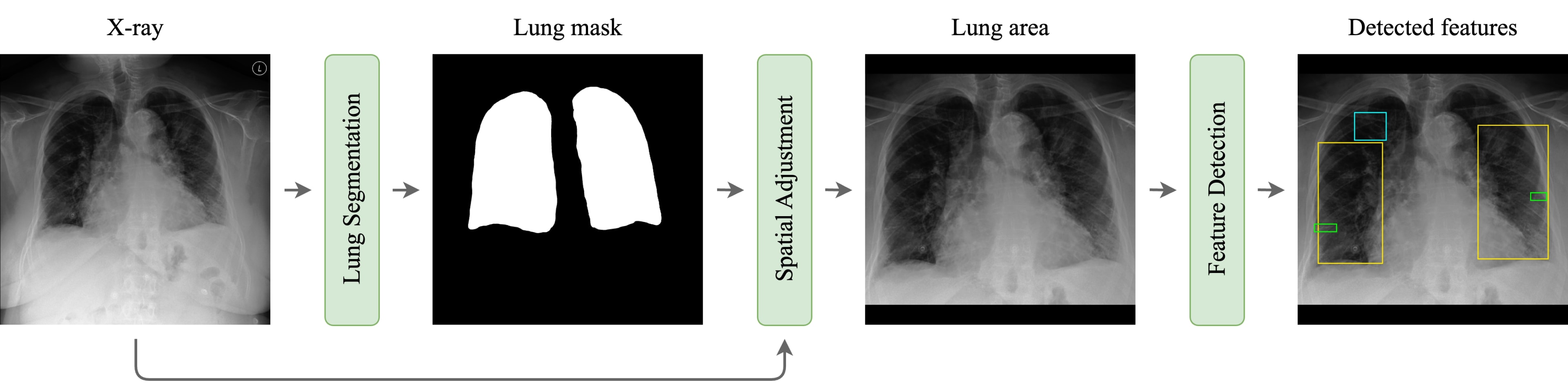 Feature Detection Workflow