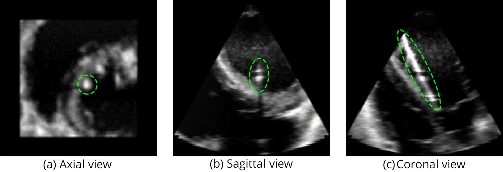 Catheter Source Data