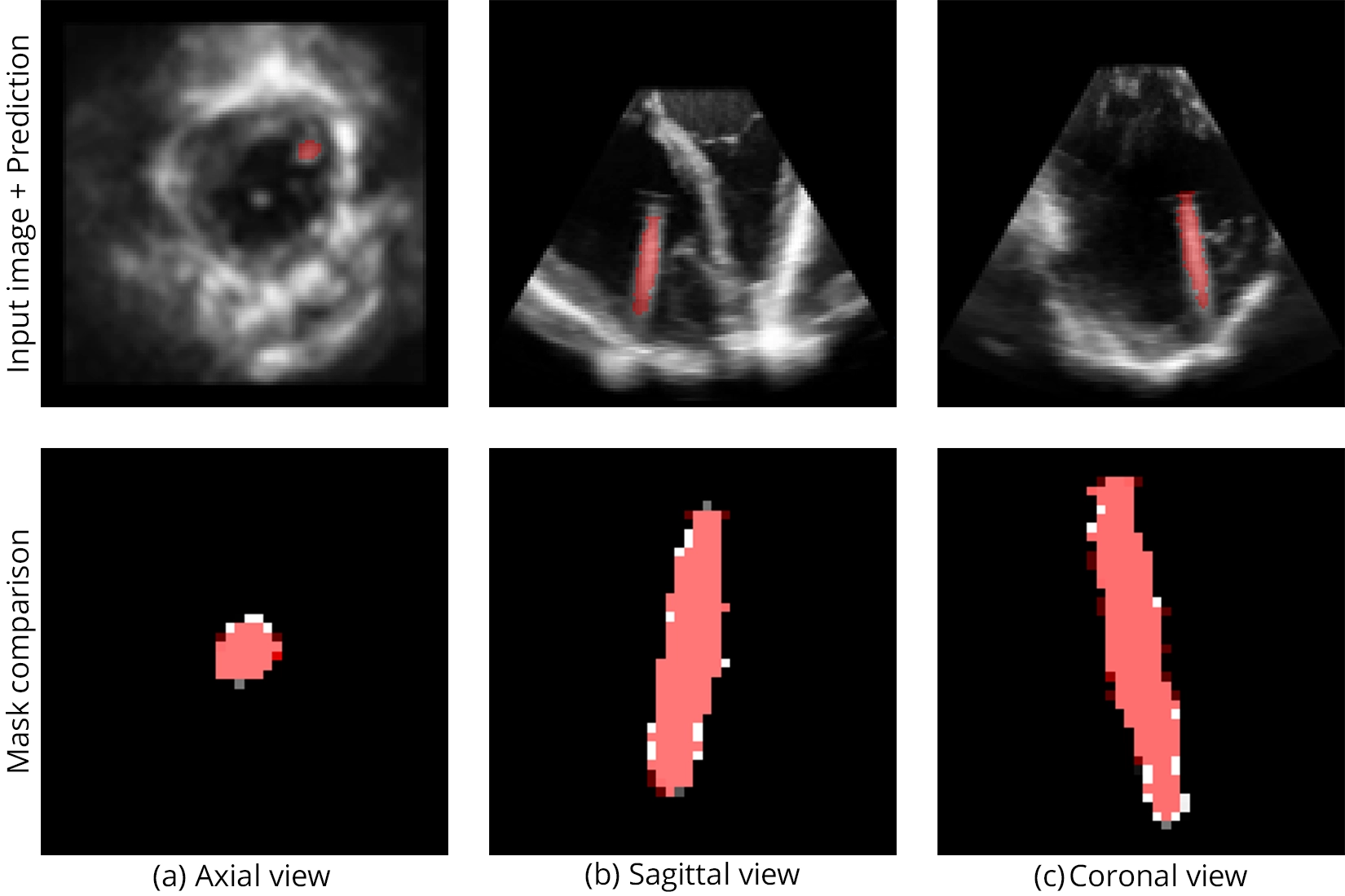 Segmentation of Real Sample